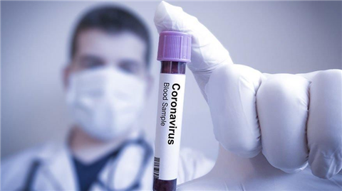 KORONAVİRÜS PCR TESTİ